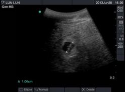 成都旅美大熊猫“伦伦”怀孕啦——宝宝或将于本月诞生